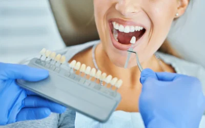 ¿Las carillas dentales son seguras para mis dientes?